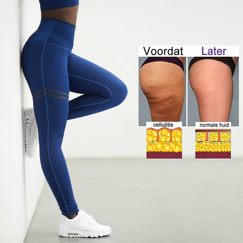 Anti-Cellulite Kompressionsleggings für Damen - SculptFit